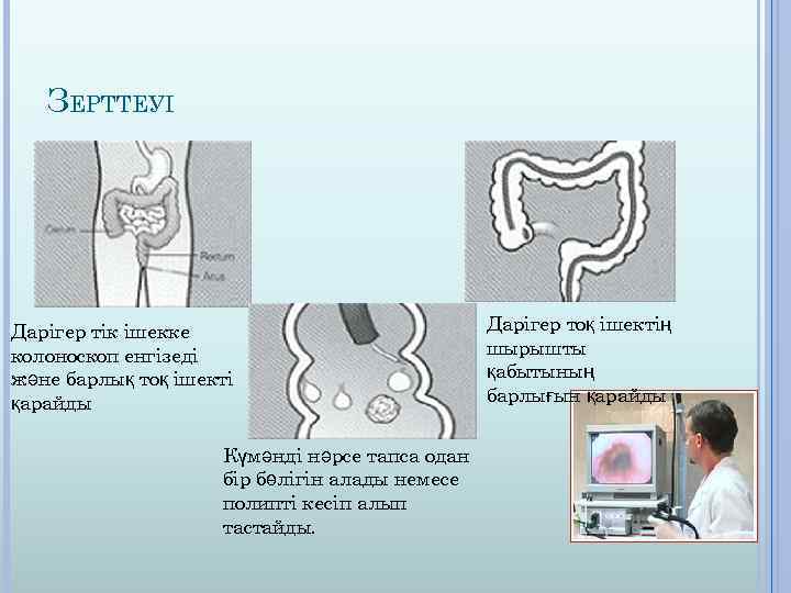 ЗЕРТТЕУІ Дарігер тік ішекке колоноскоп енгізеді және барлық тоқ ішекті қарайды Күмәнді нәрсе тапса