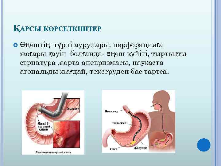 Өңеш обыры презентация