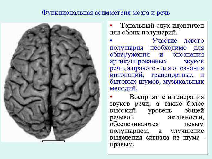 Нарушение коры полушарий. Асимметрия функций головного мозга. Функциональная асимметрия мозга. Функциональная межполушарная асимметрия. Функциональная асимметрия коры мозга человека.