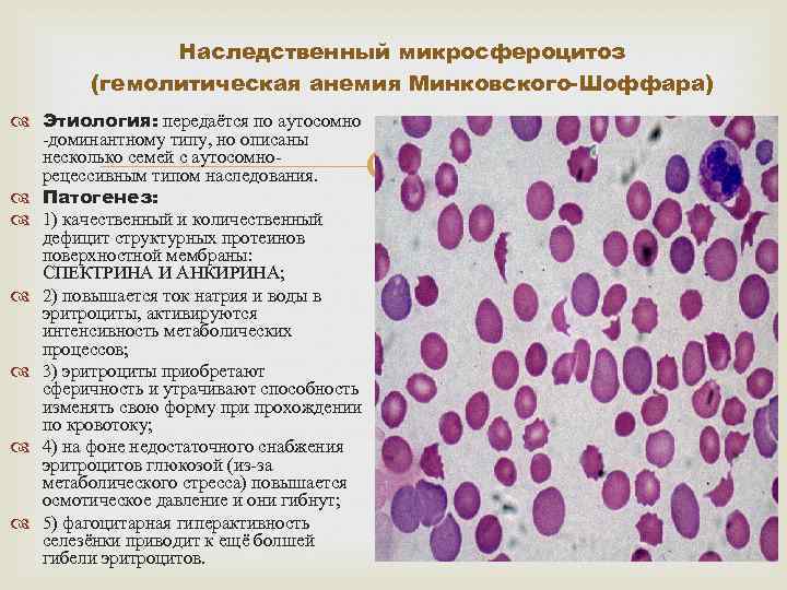 Наследственный микросфероцитоз (гемолитическая анемия Минковского-Шоффара) Этиология: передаётся по аутосомно -доминантному типу, но описаны несколько