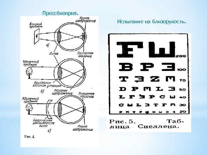Прессбиоприя. Испытание на близорукость. 