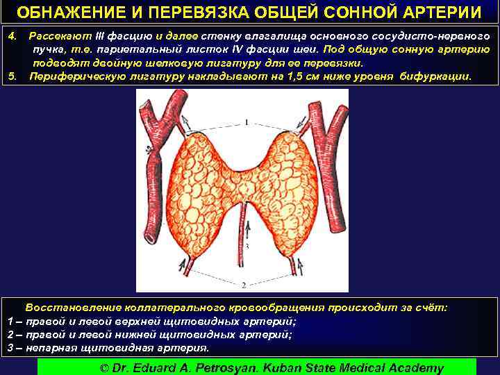 ОБНАЖЕНИЕ И ПЕРЕВЯЗКА ОБЩЕЙ СОННОЙ АРТЕРИИ 4. 5. Рассекают III фасцию и далее стенку