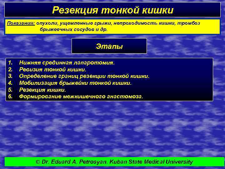 Резекция тонкой кишки Показания: опухоли, ущемленные грыжи, непроходимость кишки, тромбоз брыжеечных сосудов и др.
