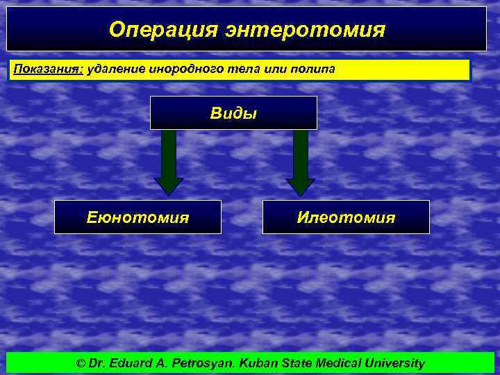 Операция энтеротомия Показания: удаление инородного тела или полипа Виды Еюнотомия Илеотомия © Dr. Eduard