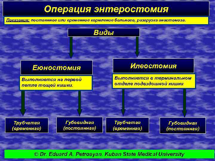 Операция энтеростомия Показания: постоянное или временное кормление больного, разгрузка анастомоза. Виды Еюностомия Выполняется на