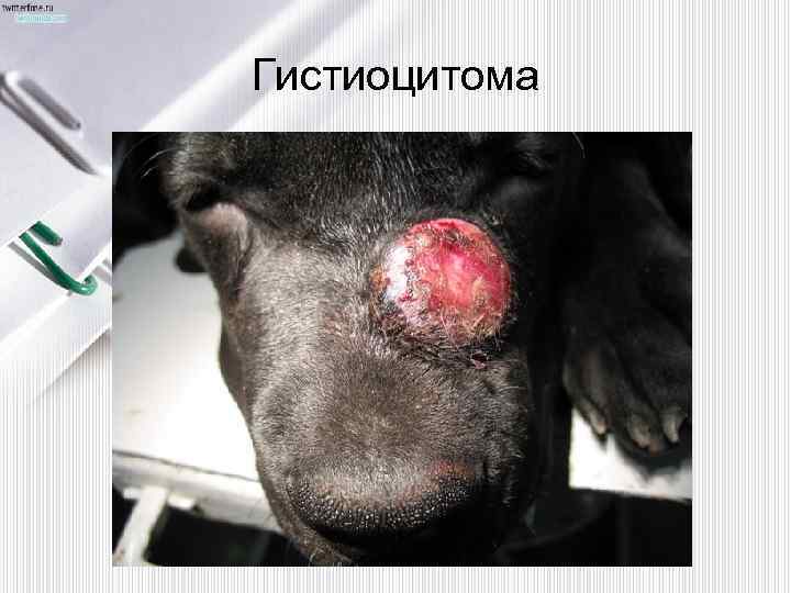 Гистиоцитома 