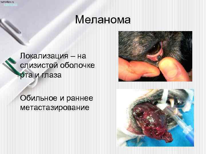 Меланома Локализация – на слизистой оболочке рта и глаза Обильное и раннее метастазирование 