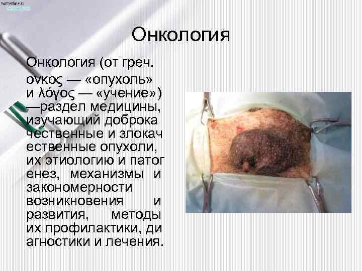 Онкология (от греч. ονκος — «опухоль» и λόγος — «учение» ) — аздел медицины,