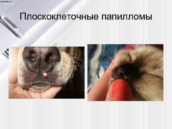 Плоскоклеточные папилломы 