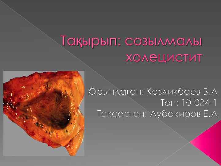 Холецистит картинки для буклета