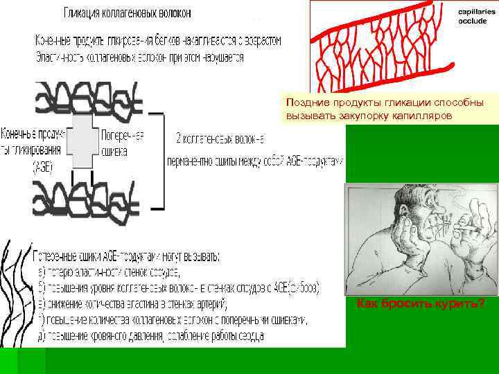 Поздние продукты гликации способны вызывать закупорку капилляров Как бросить курить? 