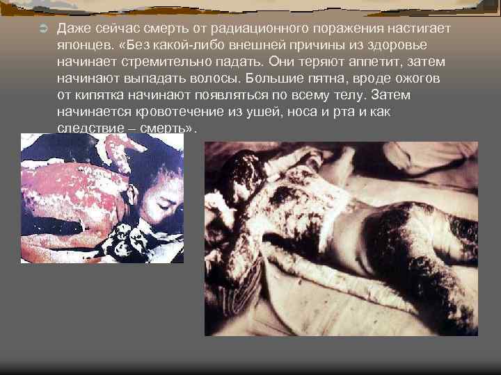 Ü Даже сейчас смерть от радиационного поражения настигает японцев. «Без какой-либо внешней причины из