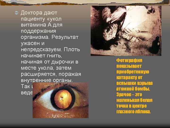 Ü Доктора дают пациенту «укол витамина А для поддержания организма. Результат ужасен и непредсказуем.