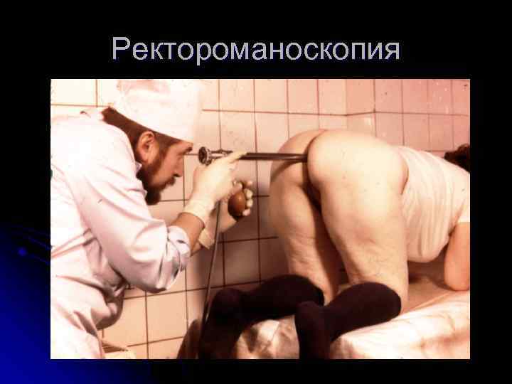 Ректороманоскопия 