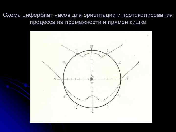 Схема циферблат часов для ориентации и протоколирования процесса на промежности и прямой кишке 