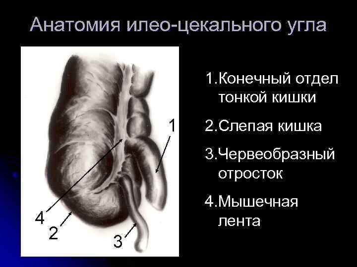 Слепая кишка короткая. Червеобразный отросток слепой кишки (аппендикс). Слепая кишка с аппендицитом. Строение червеобразного отростка анатомия. Червеобразный отросток слепой кишки латынь.