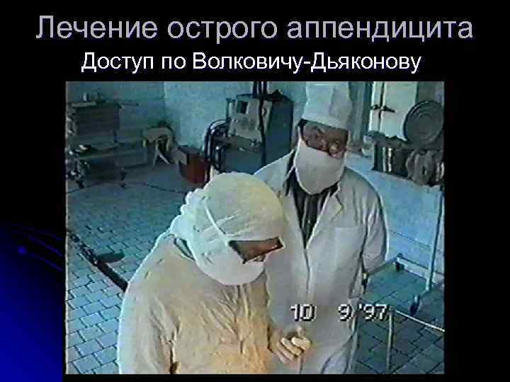 Лечение острого аппендицита Доступ по Волковичу-Дьяконову 