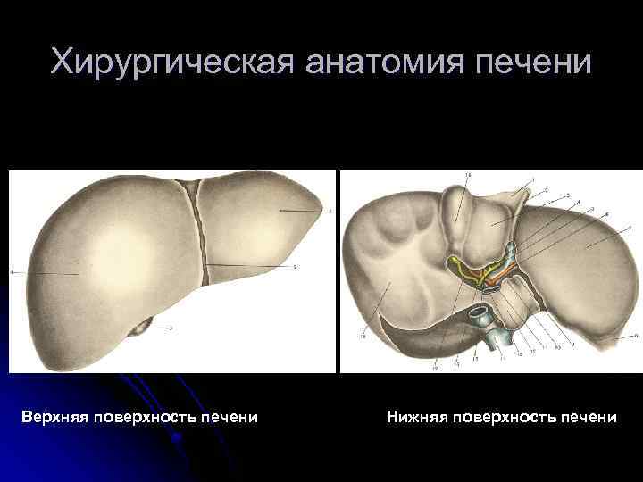 Хирургическая анатомия печени Верхняя поверхность печени Нижняя поверхность печени 