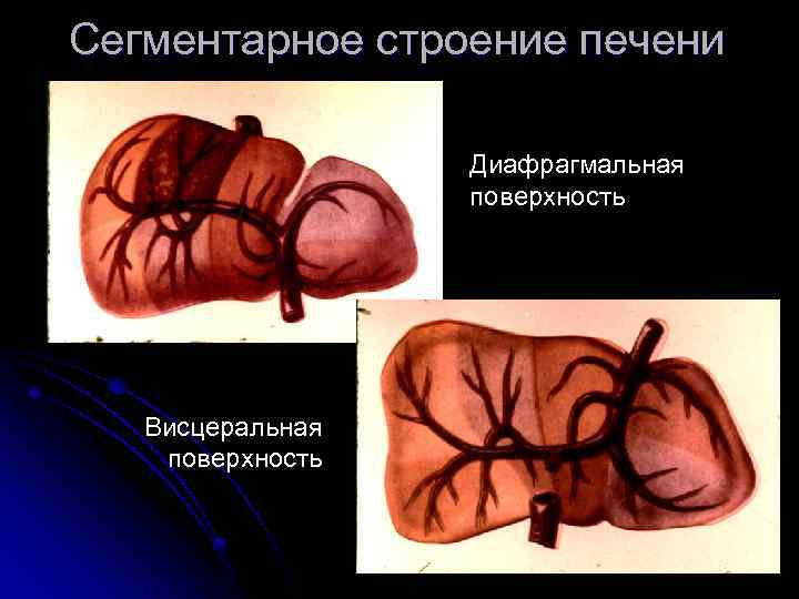 Сегментарное строение печени Диафрагмальная поверхность Висцеральная поверхность 