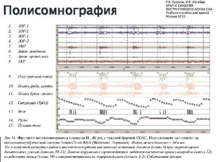 Полисомнография Цена В Москве