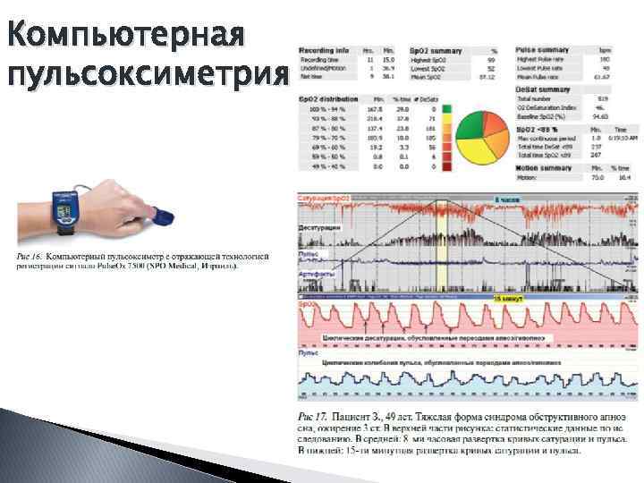 Компьютерная пульсоксиметрия 