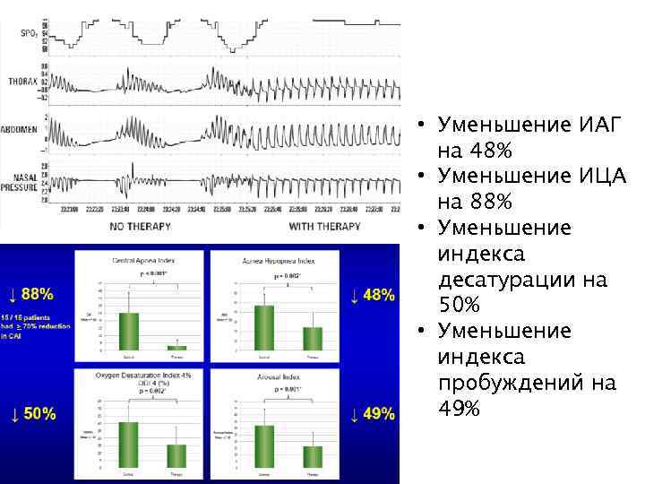  • Уменьшение ИАГ на 48% • Уменьшение ИЦА на 88% • Уменьшение индекса