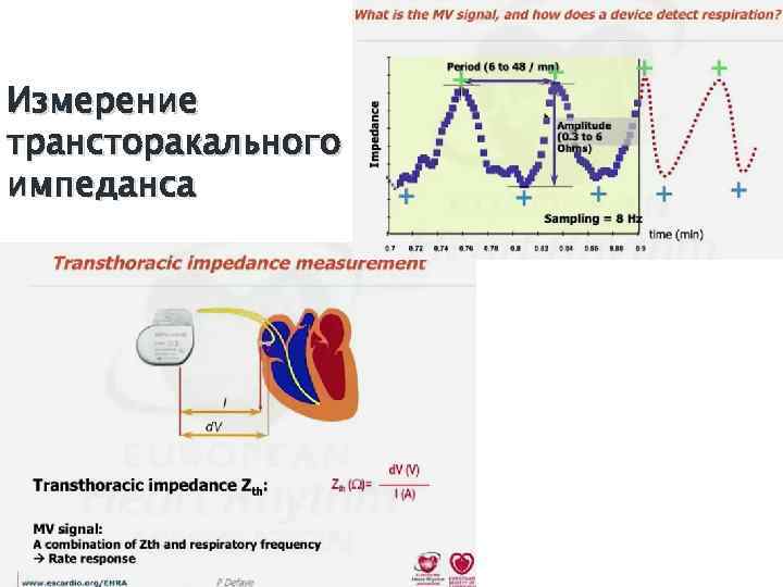 Измерение трансторакального импеданса 