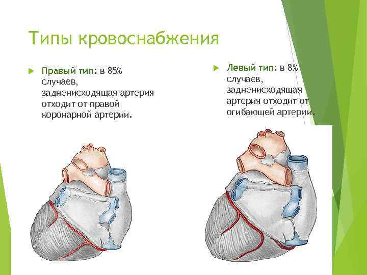 Типы кровоснабжения Правый тип: в 85% случаев, задненисходящая артерия отходит от правой коронарной артерии.
