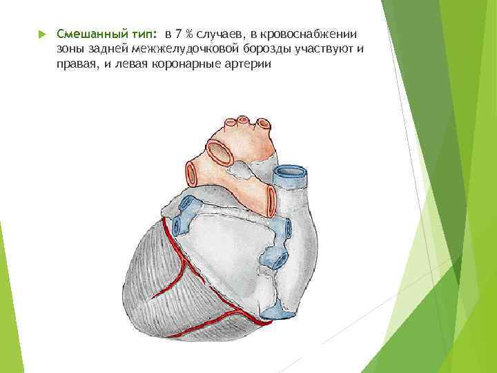  Смешанный тип: в 7 % случаев, в кровоснабжении зоны задней межжелудочковой борозды участвуют