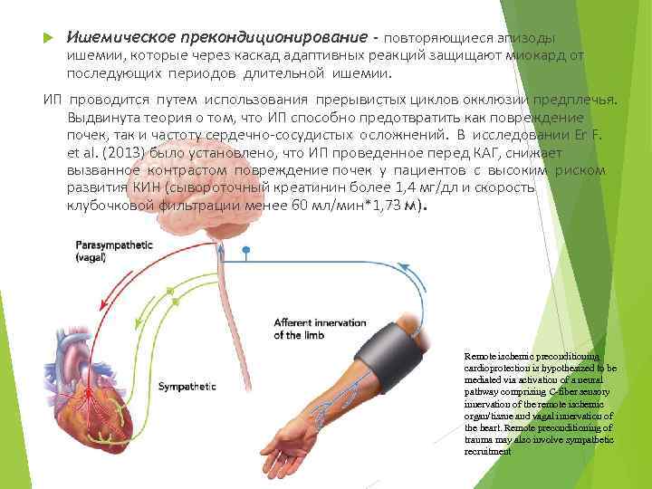  Ишемическое прекондиционирование - повторяющиеся эпизоды ишемии, которые через каскад адаптивных реакций защищают миокард