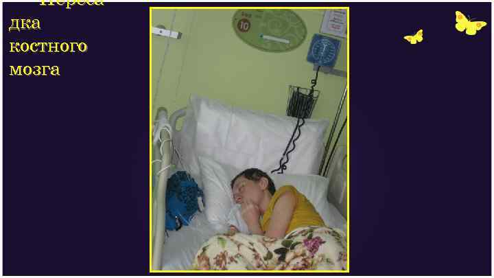 Переса дка костного мозга 