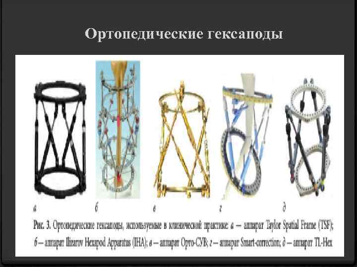 Ортопедические гексаподы 