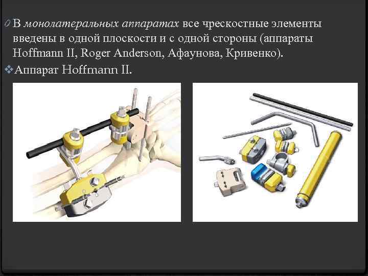 0 В монолатеральных аппаратах все чрескостные элементы введены в одной плоскости и с одной