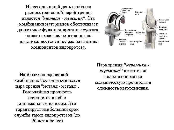 На сегодняшний день наиболее распространенной парой трения является 