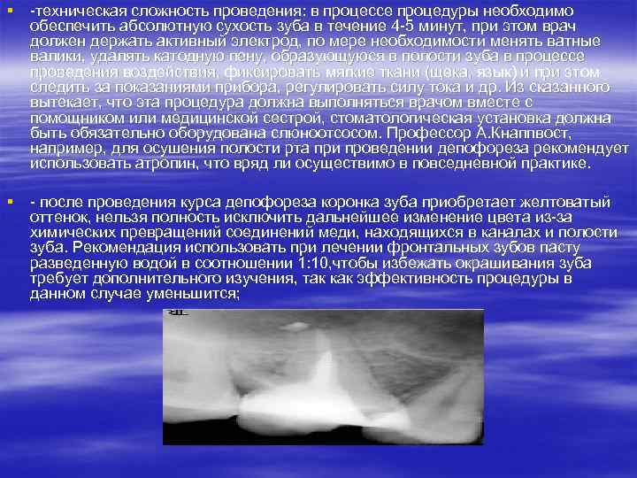 § -техническая сложность проведения: в процессе процедуры необходимо обеспечить абсолютную сухость зуба в течение