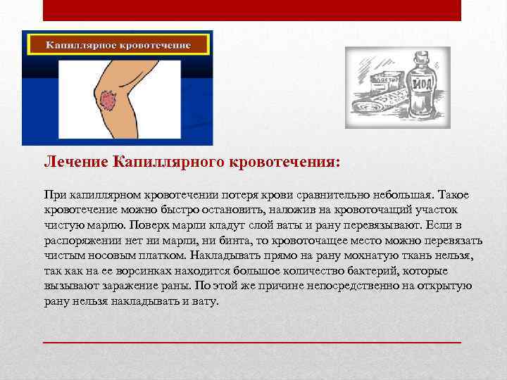 Лечение Капиллярного кровотечения: При капиллярном кровотечении потеря крови сравнительно небольшая. Такое кровотечение можно быстро