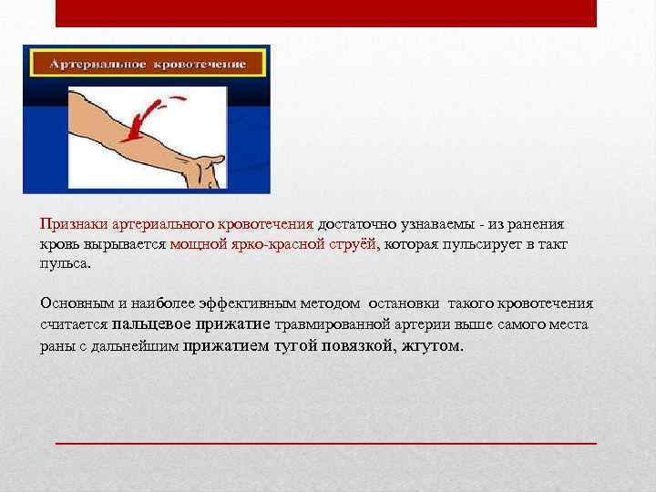 Признаки артериального кровотечения достаточно узнаваемы - из ранения кровь вырывается мощной ярко-красной струёй, которая