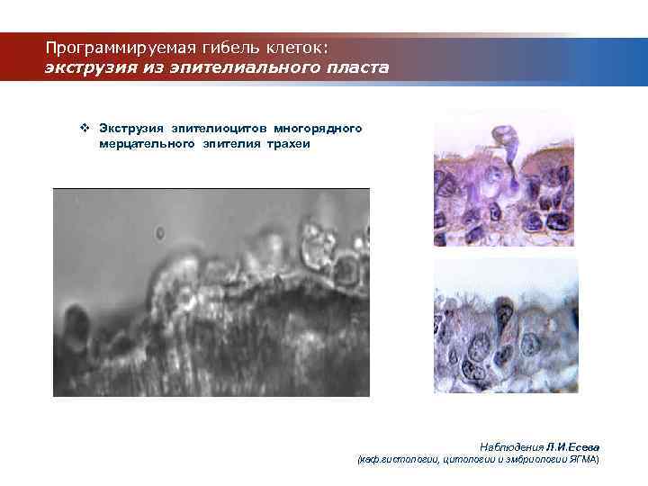 Программируемая гибель клеток: экструзия из эпителиального пласта v Экструзия эпителиоцитов многорядного мерцательного эпителия трахеи