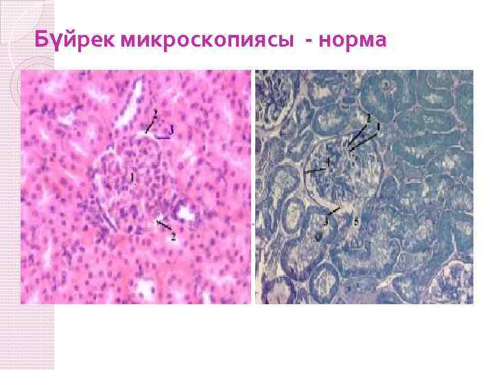 Бүйрек микроскопиясы - норма 