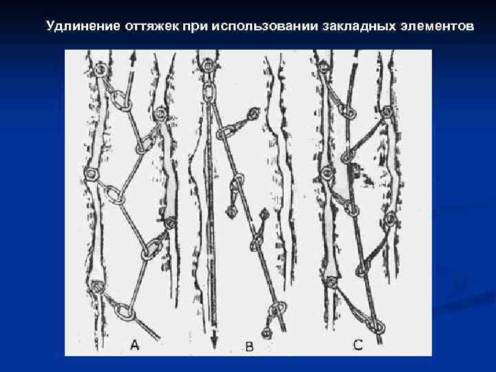 Удлинение оттяжек при использовании закладных элементов 