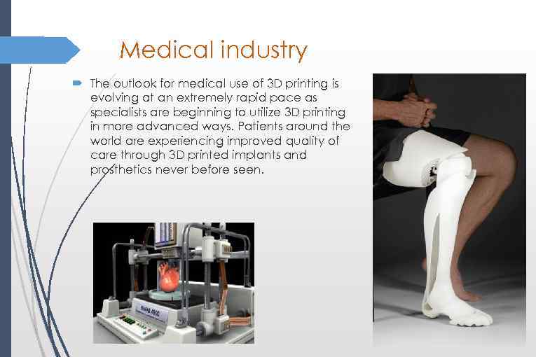 Medical industry The outlook for medical use of 3 D printing is evolving at