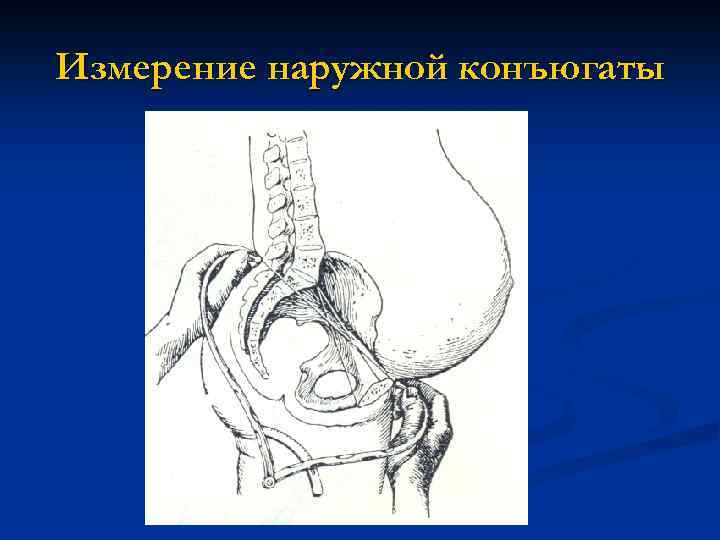 Измерение наружной конъюгаты 