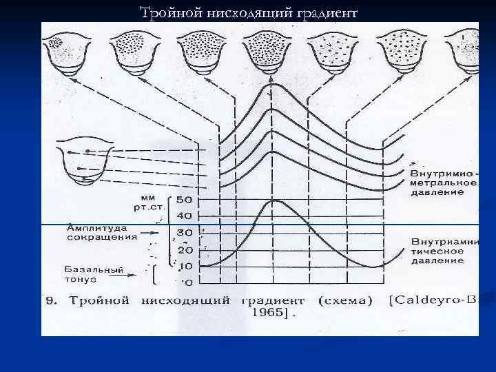 Тройной нисходящий градиент 