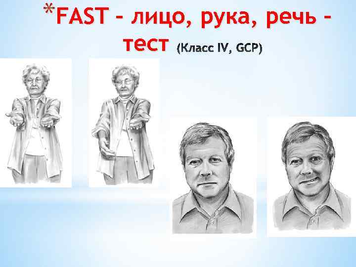 *FAST – лицо, рука, речь – тест 