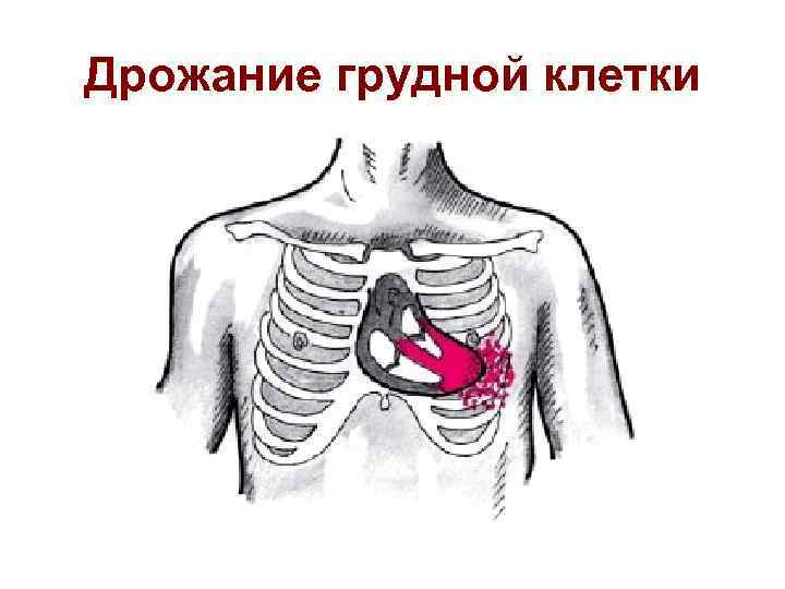 Дрожание грудной клетки 