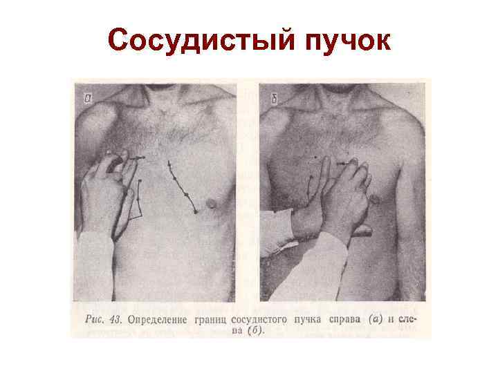 Сосудистый пучок 