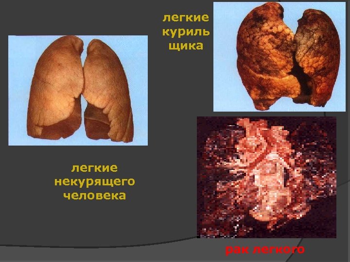 легкие куриль щика легкие некурящего человека рак легкого 