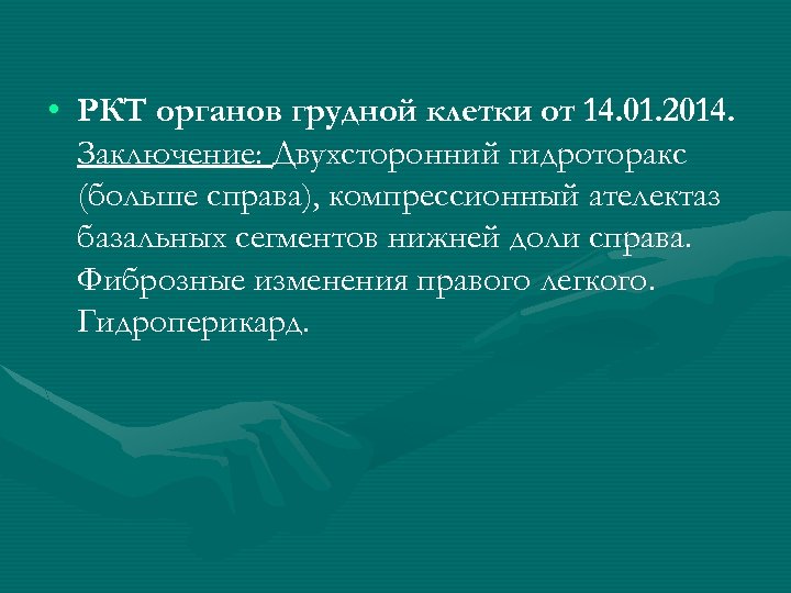  • РКТ органов грудной клетки от 14. 01. 2014. Заключение: Двухсторонний гидроторакс (больше