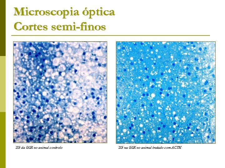 Microscopia óptica Cortes semi-finos ZG da GSR no animal controlo ZG na GSR no