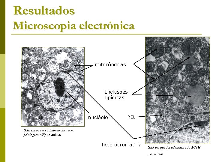 Resultados Microscopia electrónica mitocôndrias Inclusões lipídicas nucléolo REL GSR em que foi administrado soro